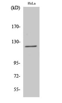 Atrophin-1 rabbit pAb Antibody