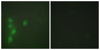 AW-1 rabbit pAb Antibody