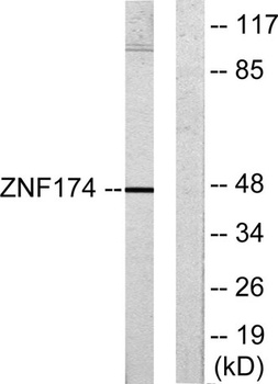AW-1 rabbit pAb Antibody