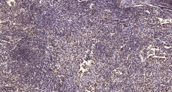 AW-1 rabbit pAb Antibody