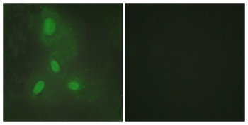 BACH1 rabbit pAb Antibody
