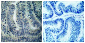 Bad rabbit pAb Antibody