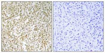 BARD1 rabbit pAb Antibody