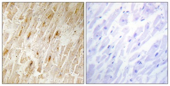 BCA3 rabbit pAb Antibody