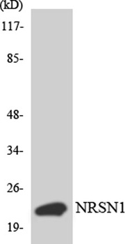 BCA3 rabbit pAb Antibody
