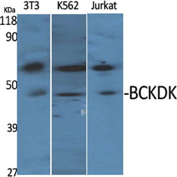 BCKDK rabbit pAb Antibody