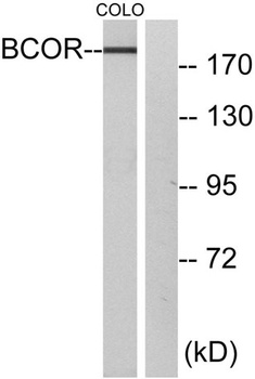 BCoR rabbit pAb Antibody