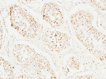 BM28 rabbit pAb Antibody