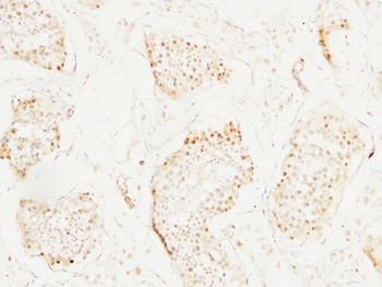 BM28 rabbit pAb Antibody