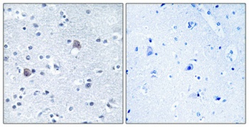 BMP-8A rabbit pAb Antibody