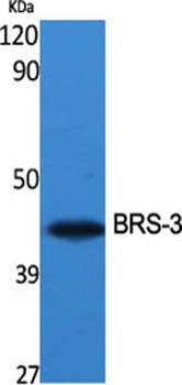 BRS-3 rabbit pAb Antibody
