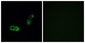 BRS-3 rabbit pAb Antibody