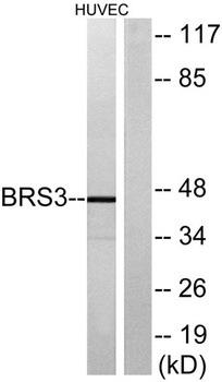 BRS-3 rabbit pAb Antibody