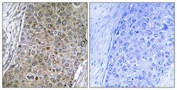 C/EBP ζ rabbit pAb Antibody