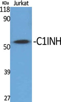 C1INH rabbit pAb Antibody