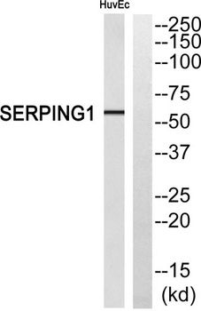 C1INH rabbit pAb Antibody