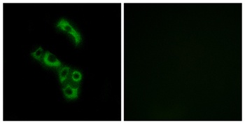 C1q-B rabbit pAb Antibody