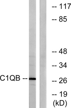 C1q-B rabbit pAb Antibody