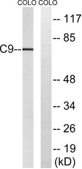 C9 rabbit pAb Antibody
