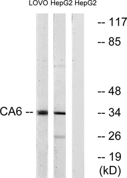 CA VI rabbit pAb Antibody