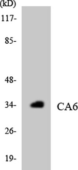 CA VI rabbit pAb Antibody