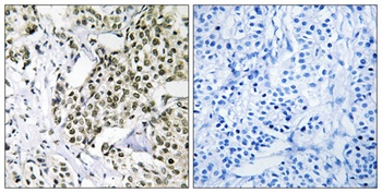 CAGE-1 rabbit pAb Antibody