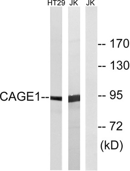 CAGE-1 rabbit pAb Antibody