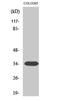 Calponin 2 rabbit pAb Antibody