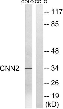 Calponin 2 rabbit pAb Antibody