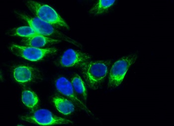 Calregulin rabbit pAb Antibody