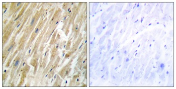 Calregulin rabbit pAb Antibody