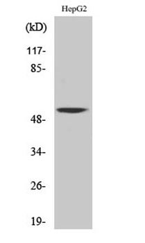 CaMKV rabbit pAb Antibody