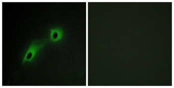 CaMKV rabbit pAb Antibody