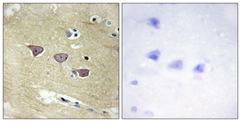 CaMKV rabbit pAb Antibody