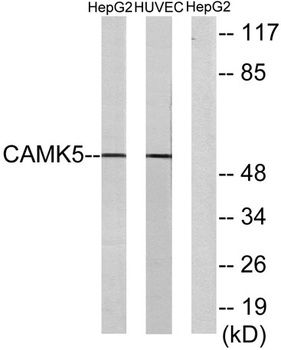 CaMKV rabbit pAb Antibody