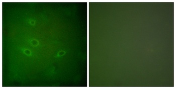 CARD 6 rabbit pAb Antibody