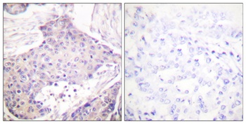 CARD 6 rabbit pAb Antibody