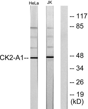 Casein Kinase IIα rabbit pAb Antibody