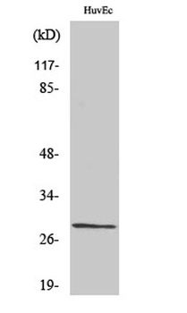 Casein Kinase IIβ rabbit pAb Antibody