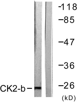 Casein Kinase IIβ rabbit pAb Antibody