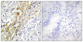 Casein Kinase Iα rabbit pAb Antibody