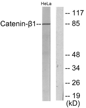 Catenin-β1 rabbit pAb Antibody