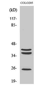 Cathepsin B rabbit pAb Antibody