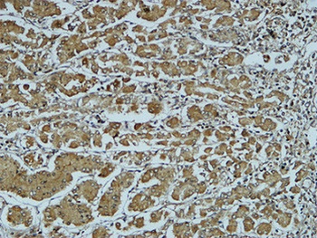 Cathepsin B rabbit pAb Antibody