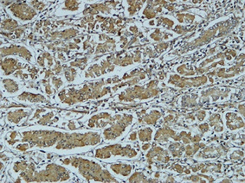Cathepsin B rabbit pAb Antibody