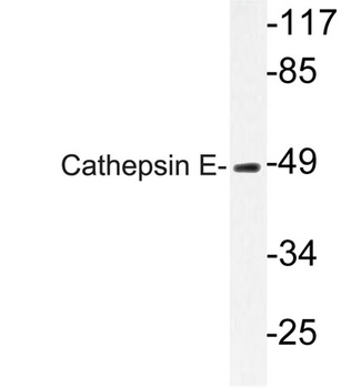 Cathepsin E rabbit pAb Antibody