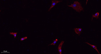 Caveolin-1 rabbit pAb Antibody