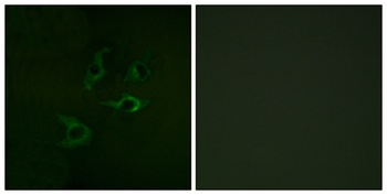 Cbl rabbit pAb Antibody