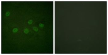 CBP rabbit pAb Antibody