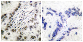 CBP rabbit pAb Antibody
